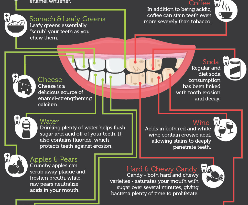 Nutrition dental infographic